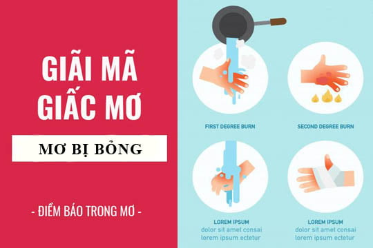 Giải mã giấc mơ: Nằm mơ thấy bị bỏng điềm báo gì, lành hay dữ? con số liên quan